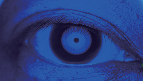 SURFACE EYE OBSERVATION